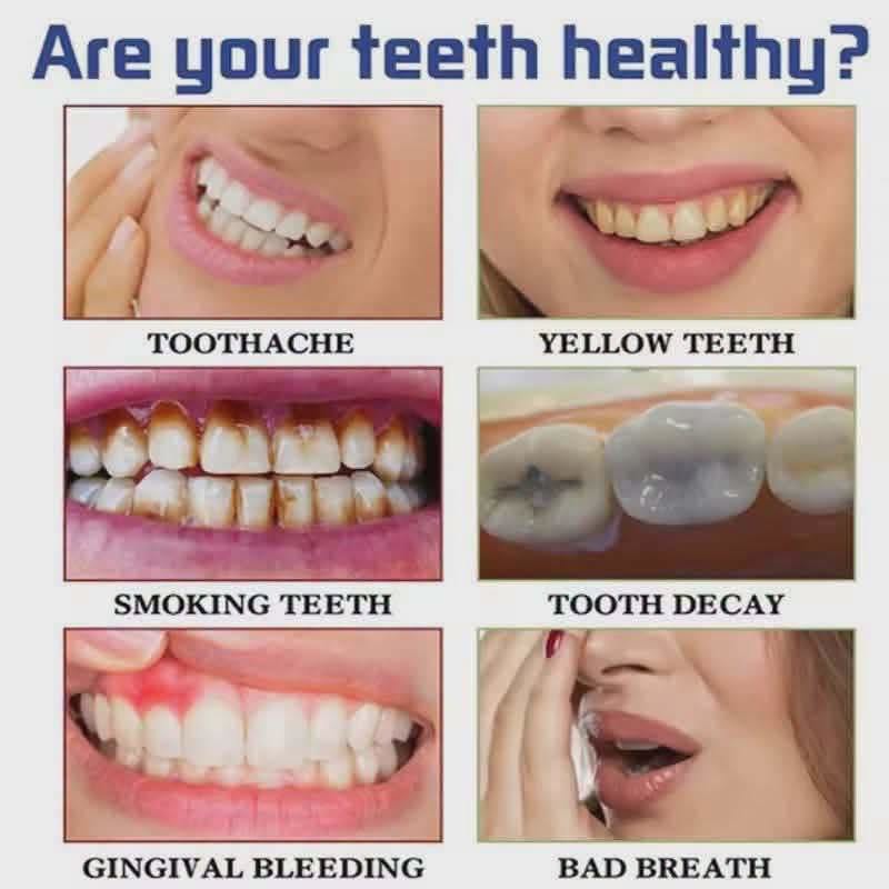 v34 hi smile toothpaste